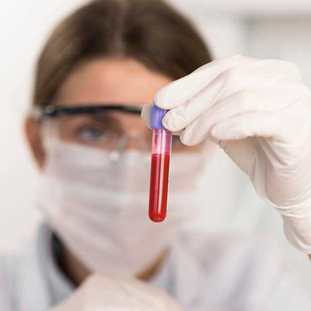 Важность анализа крови РСБ для диагностики заболеваний