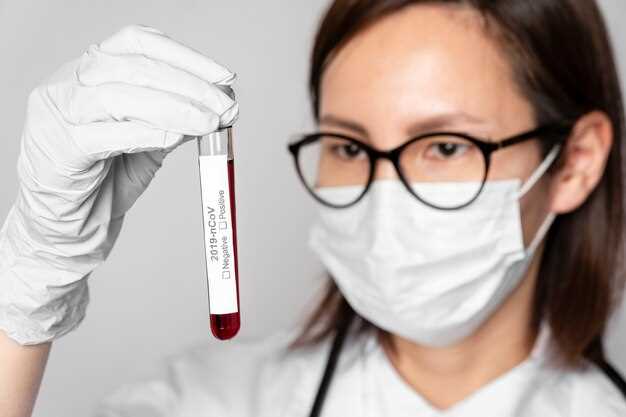 Анализ крови РСБ: зачем он нужен?