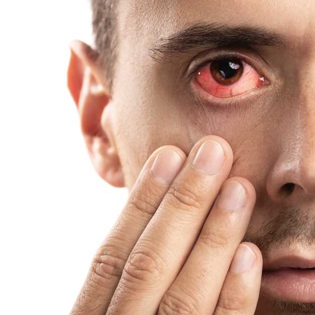 Какие фармацевтические препараты помогут при глазе, который красный, слезится и чешется?