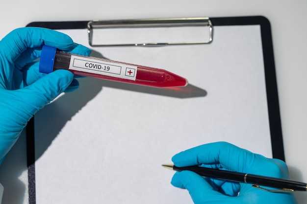 Как проверяют ВИЧ-инфекцию в лаборатории