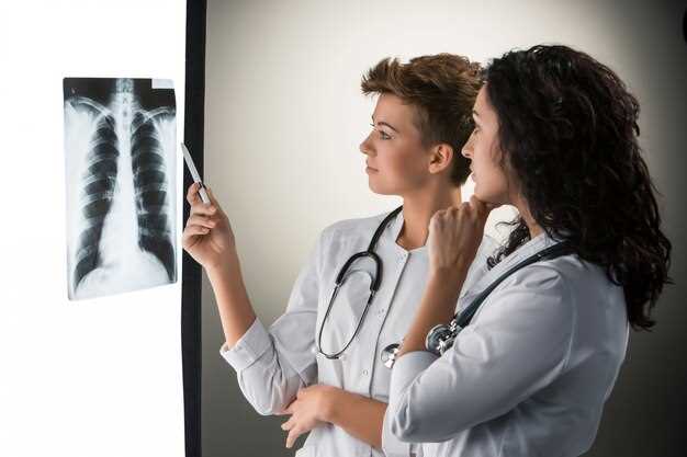 Рентгенологическое исследование в диагностике туберкулеза у взрослых