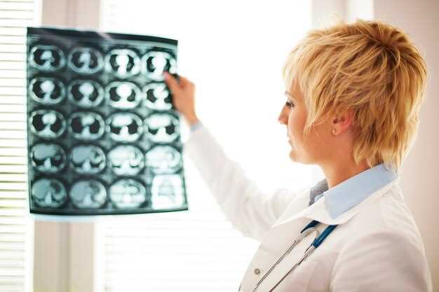 Как узнать причины боли в голове без обращения к МРТ