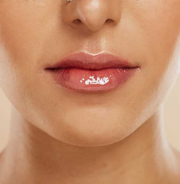Возможные причины появления гематомы на губе