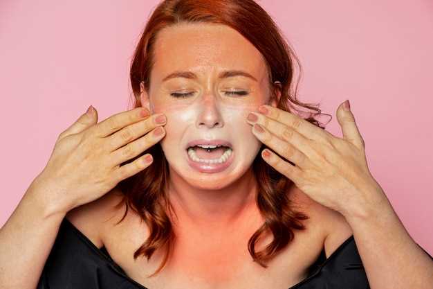 Симптомы и лечение грибка на лице