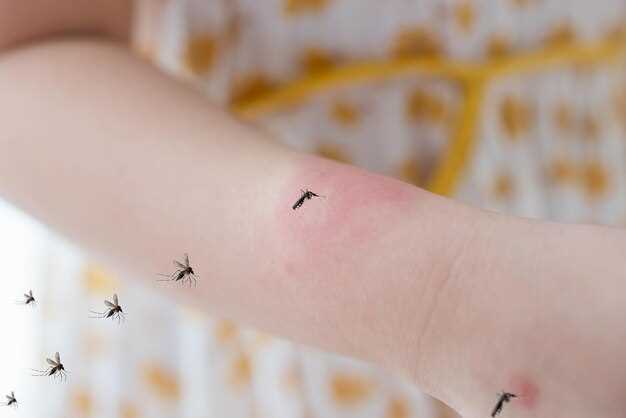 Мифы о выгляде расчесанного укуса комара