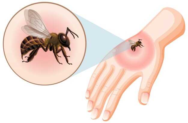 Как уберечь себя от проверки наличия укусов комара