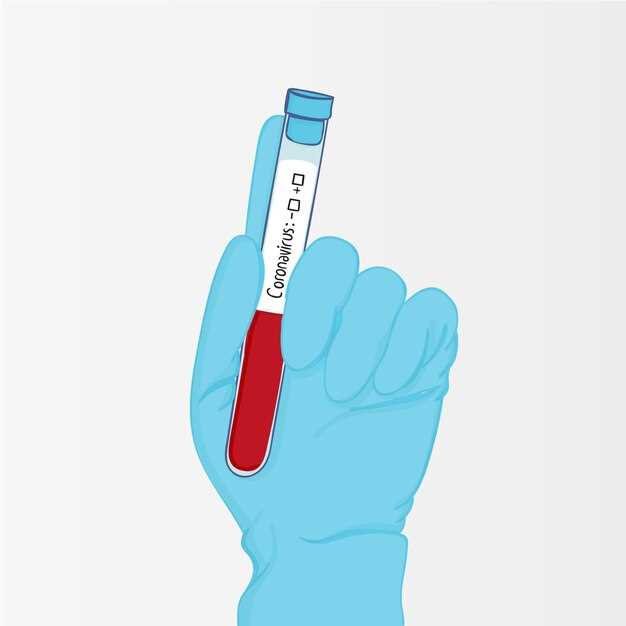 Преимущества анализа крови из вены: