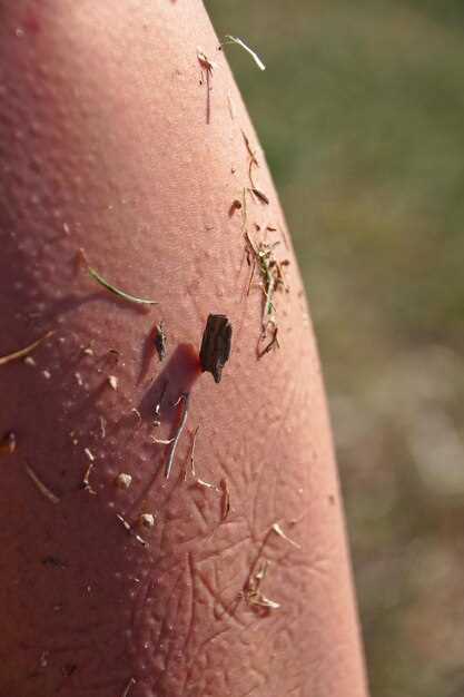 Что такое мурашки по телу и почему они возникают?