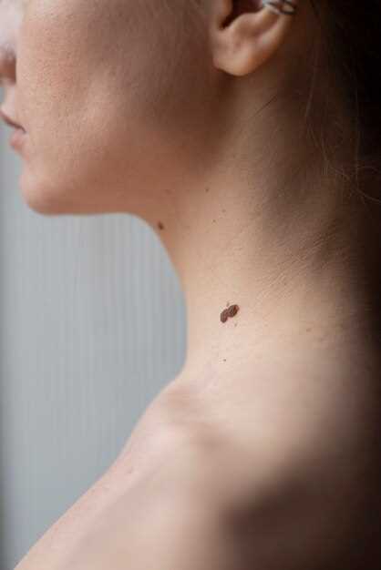 Откуда появляются мурашки на коже